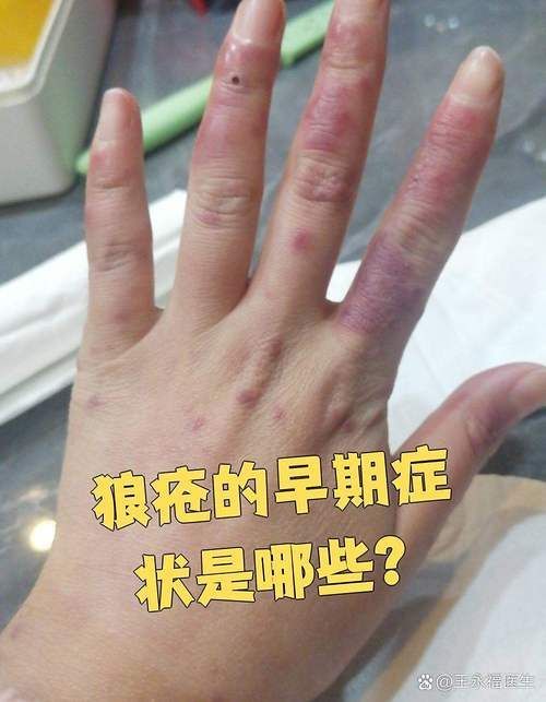 能否提供更多早期癥狀的圖片，早期癥狀的識別與分析