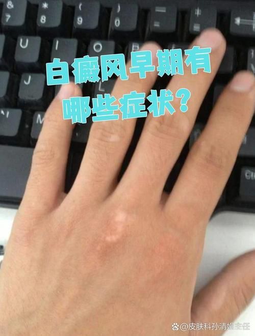 能否提供更多早期癥狀的圖片，早期癥狀的識別與分析