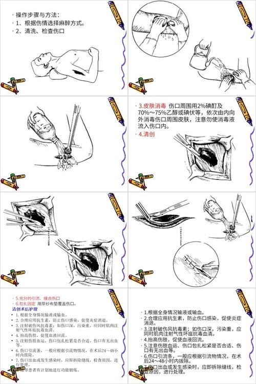 如何預防魚外傷感染，如何預防魚外傷感染及其實操指南