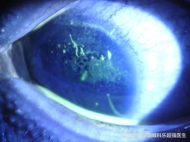 如何判斷錦鯉是否患有蒙眼病，如何判斷錦鯉患有蒙眼病