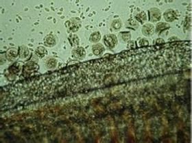 金魚寄生蟲有哪些種類，金魚寄生蟲種類繁多，主要包括以下幾種