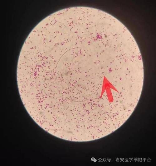如何檢測魚缸水中的致病細菌