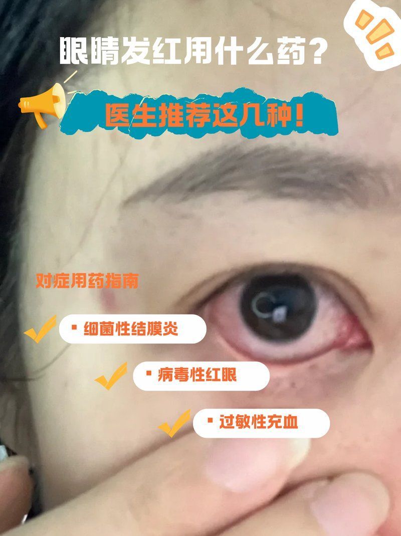 如何正確使用亞甲基藍治療蒙眼，亞甲基藍是一種常用的藥物，用于治療多種疾病，使用亞甲基藍蒙眼的方法并不正確