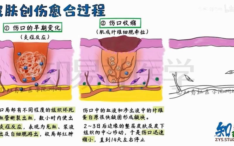被龍魚咬傷后多久會愈合，被龍魚咬傷后多久會愈合思考完成百度健康-去問診