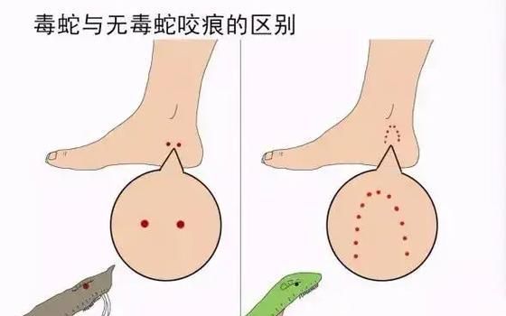 被龍魚咬傷后多久會愈合，被龍魚咬傷后多久會愈合思考完成百度健康-去問診