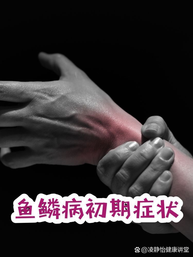 如何早期識別魚鱗片脫落和潰爛，早期識別魚鱗片脫落和潰爛