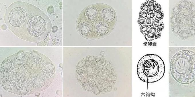 如何判斷龍魚(yú)是否感染腸道寄生蟲(chóng)，如何判斷龍魚(yú)是否感染腸道寄生蟲(chóng)思考完成-去問(wèn)診
