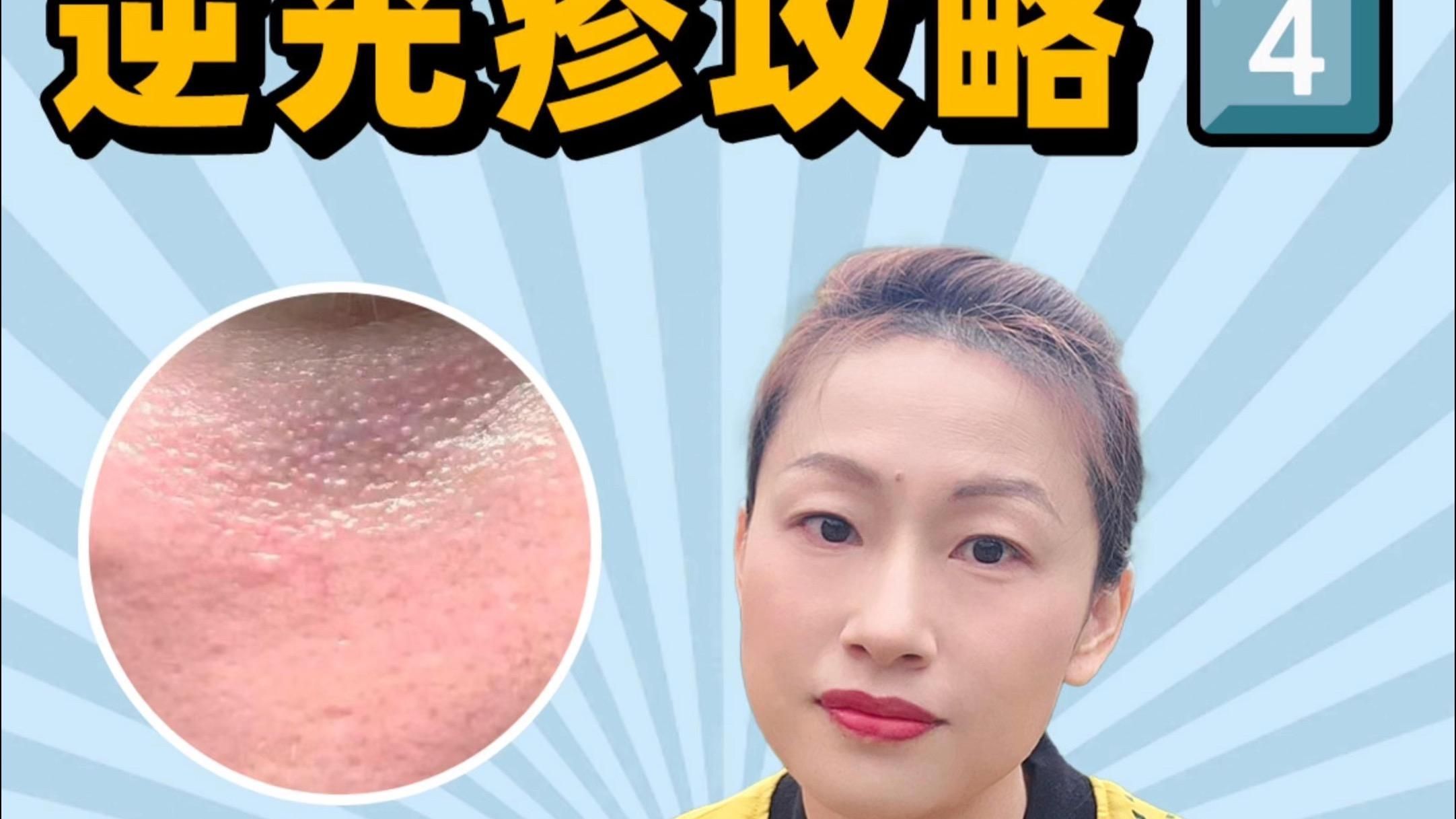 有哪些有效的去魚鱗紋產品，去魚鱗紋產品