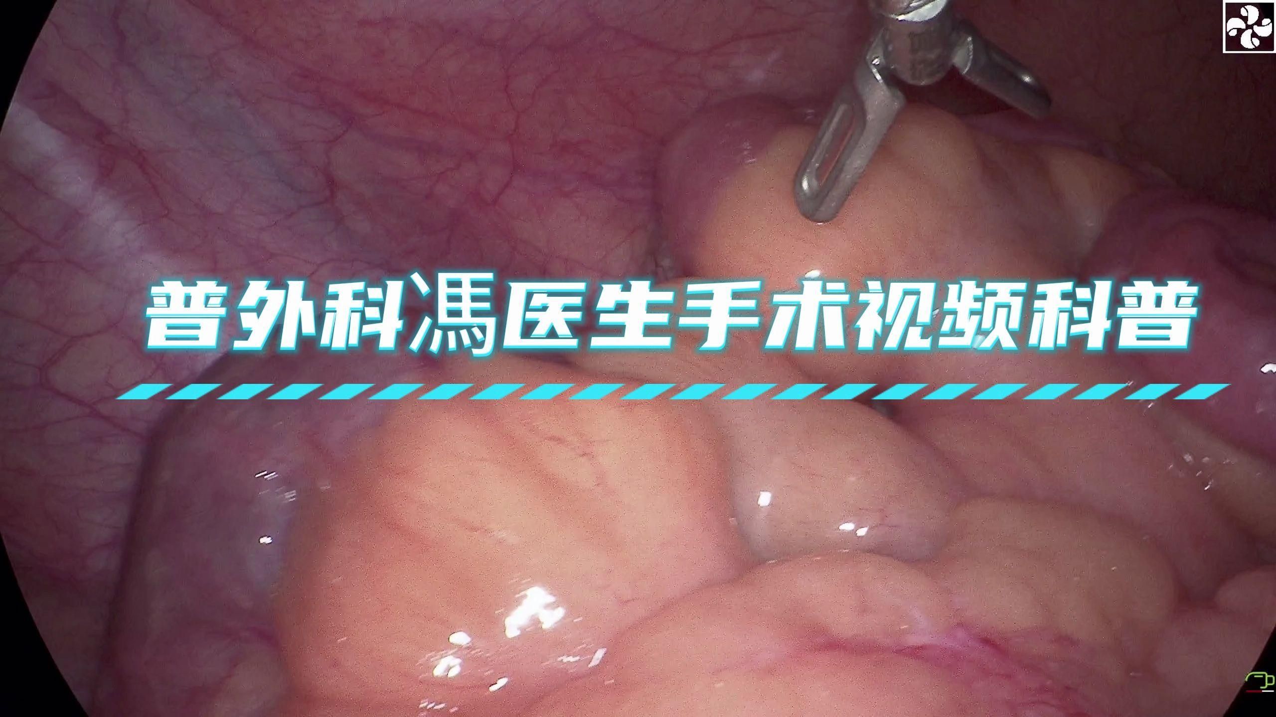爛尾病能治愈嗎，mcp工具為爛尾病的診療指南、專家推薦或治療案例