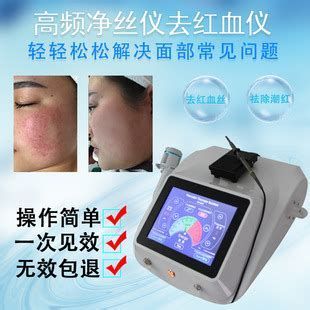 紅血絲簡單去除方法，去紅血絲前后對比圖