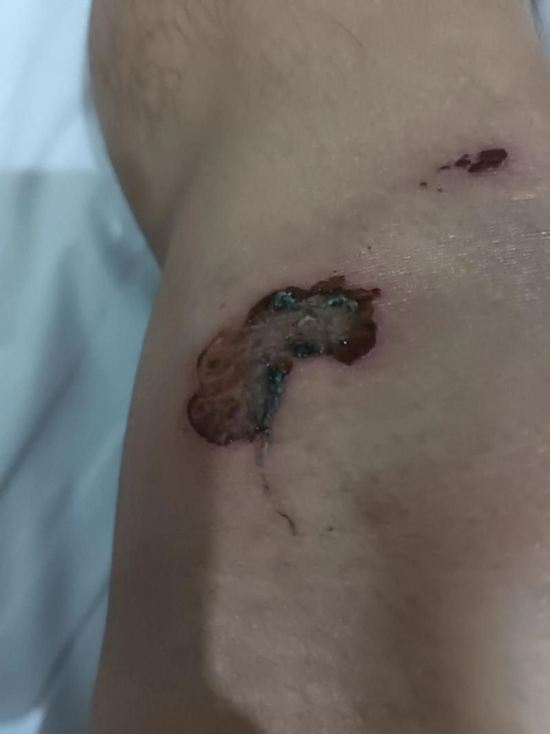 能否提供龍魚傷口愈合的詳細圖片，龍魚傷口愈合的詳細圖片描述：龍魚傷口愈合過程的詳細圖片描述
