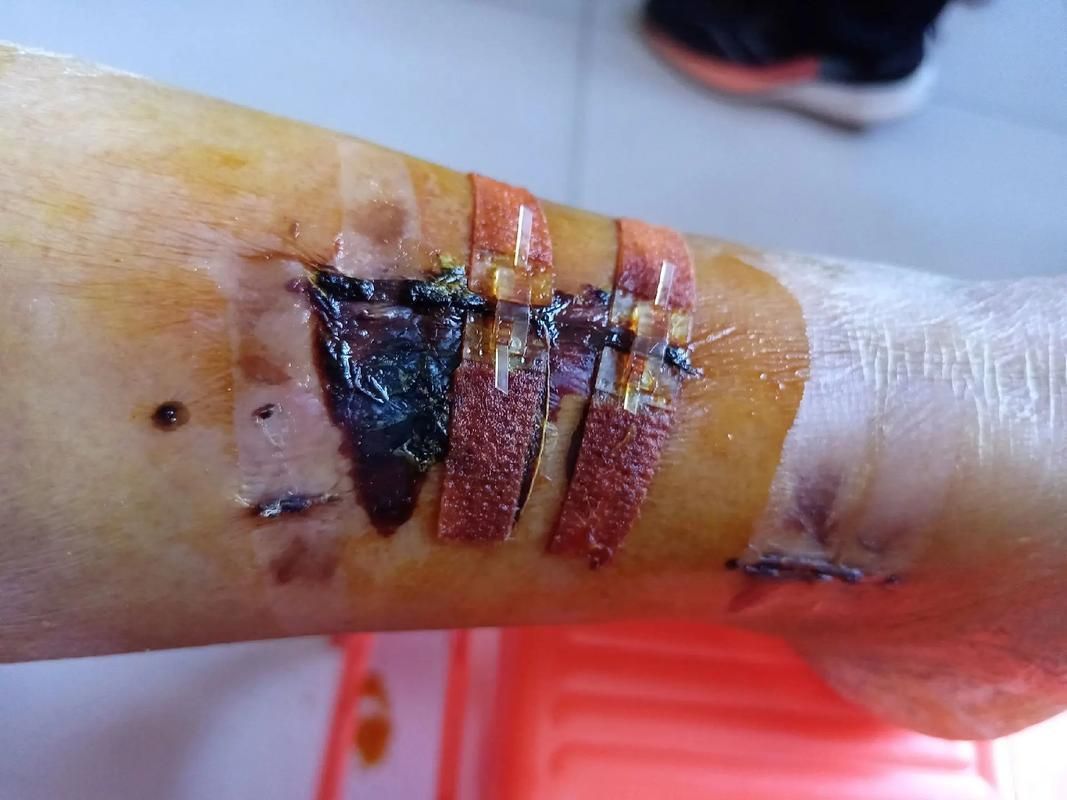 能否提供龍魚傷口愈合的詳細圖片，龍魚傷口愈合的詳細圖片描述：龍魚傷口愈合過程的詳細圖片描述