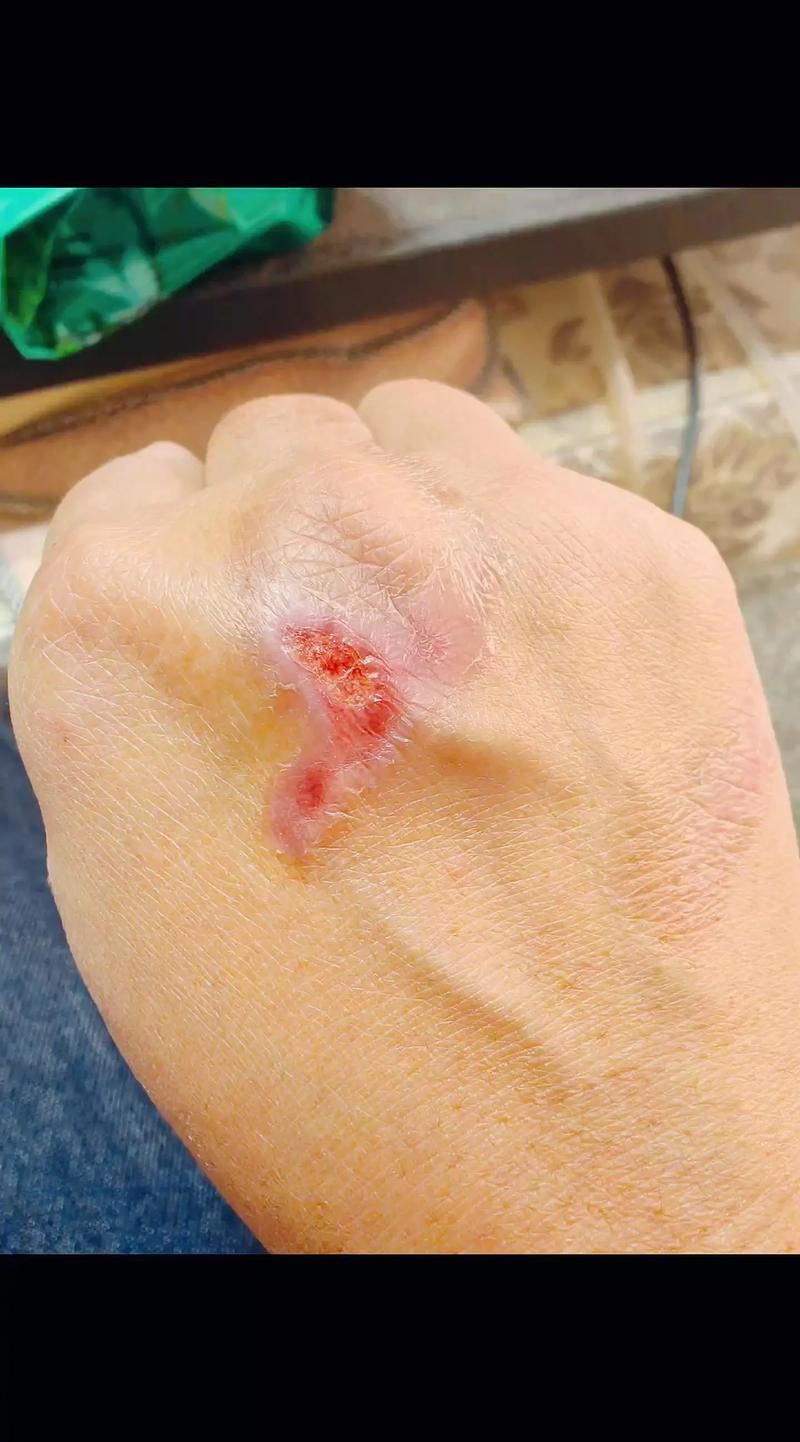 能否提供龍魚傷口愈合的詳細圖片，龍魚傷口愈合的詳細圖片描述：龍魚傷口愈合過程的詳細圖片描述