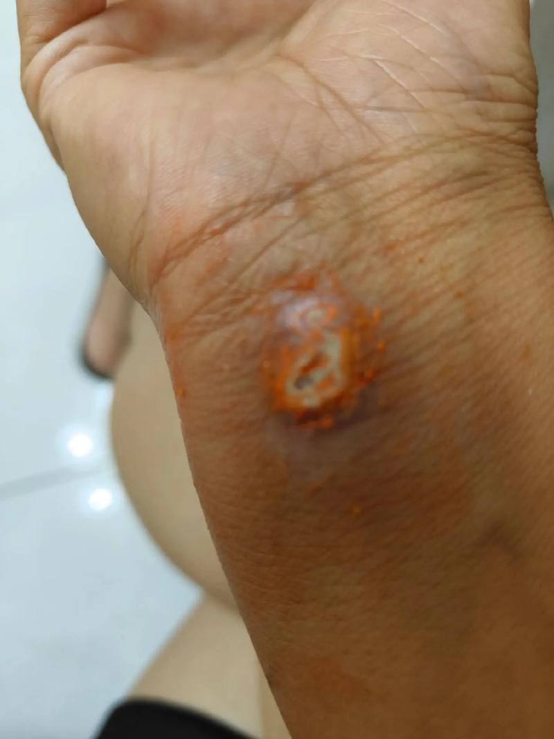 能否提供龍魚傷口愈合的詳細圖片，龍魚傷口愈合的詳細圖片描述：龍魚傷口愈合過程的詳細圖片描述