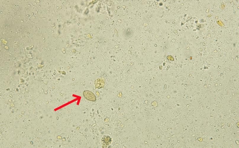 如何安全地烹飪魚以確保殺死所有寄生蟲