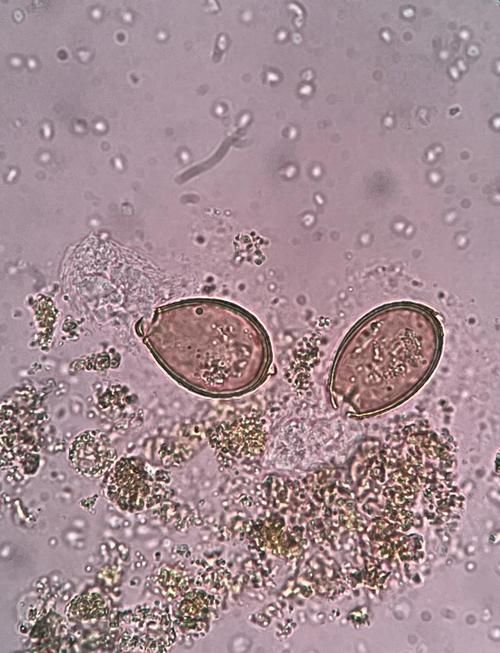 如何安全地烹飪魚以確保殺死所有寄生蟲