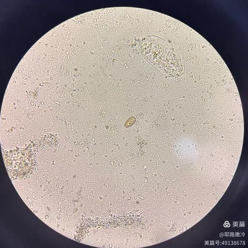 如何安全地烹飪魚以確保殺死所有寄生蟲