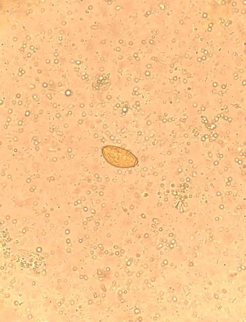 如何安全地烹飪魚以確保殺死所有寄生蟲