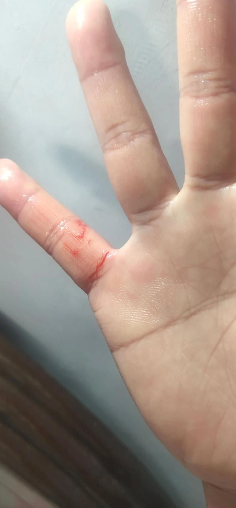 被龍魚咬傷后多久會愈合