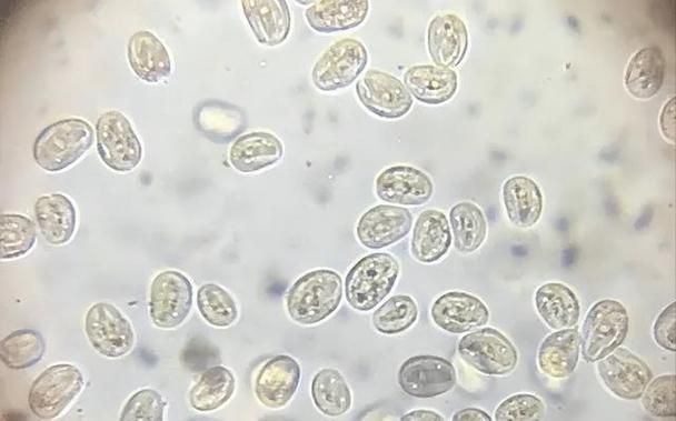 如何區分龍魚的肉疙瘩是病還是正常？，如何區分龍魚的“肉疙瘩”是病還是正常