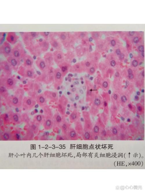 哪些藥物對魚有副作用