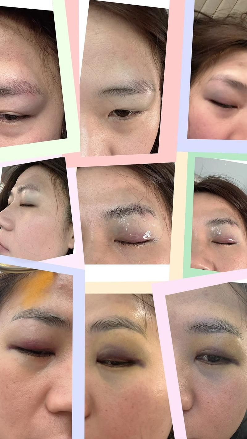 治療蒙眼病需要多長時間，三甲醫院眼科專家治療“蒙眼病”需要多長時間和配圖