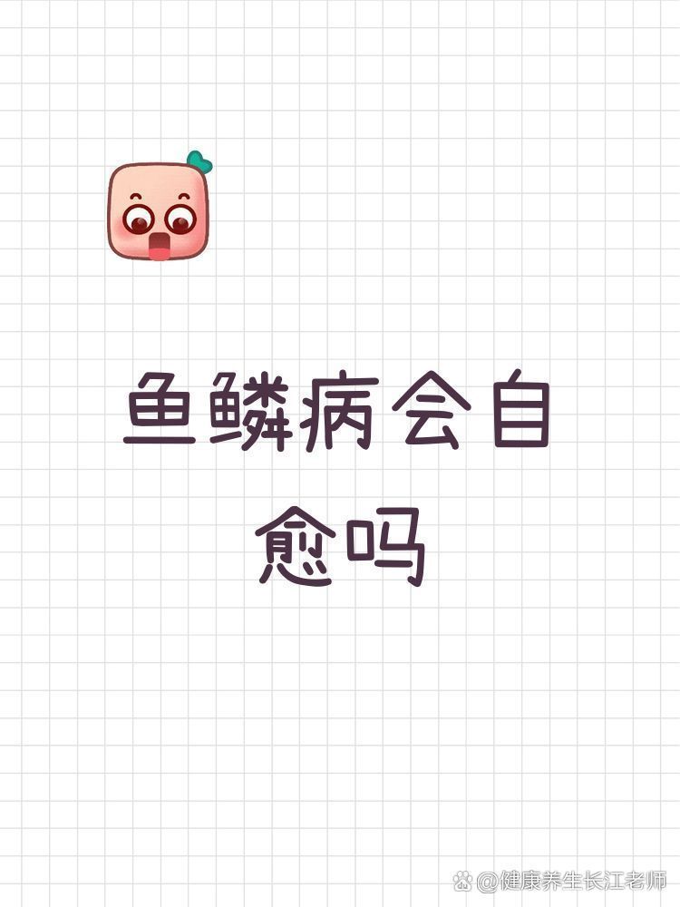 魚鱗病會(huì)自愈嗎，魚鱗病會(huì)自愈嗎，