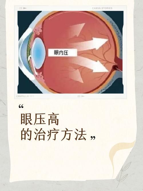 如何判斷氣蒙眼的原因，如何判斷氣蒙眼