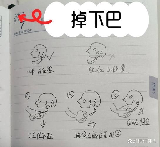 如何判斷龍魚下巴脫臼是否需要手術