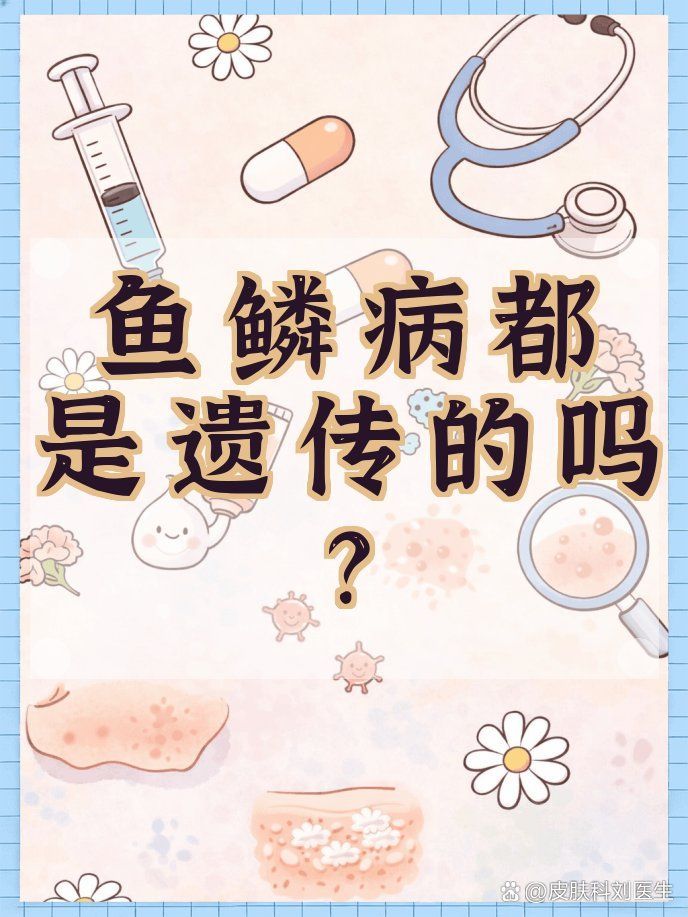 獲得性魚鱗病如何原發病得到治療，獲得性魚鱗病不是靠護膚品，而是靠護膚品，