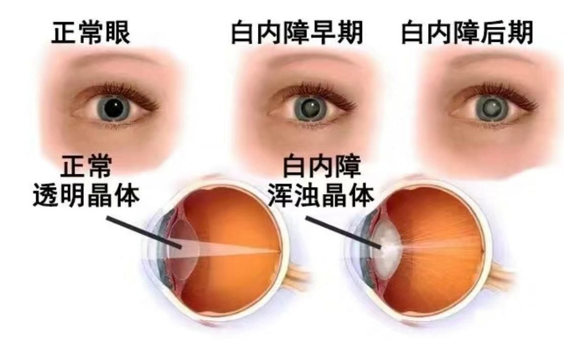 龍貓先天性疾病有哪些常見類型，龍貓先天性疾病、胸腔積液、脾臟栓塞類型思考完成
