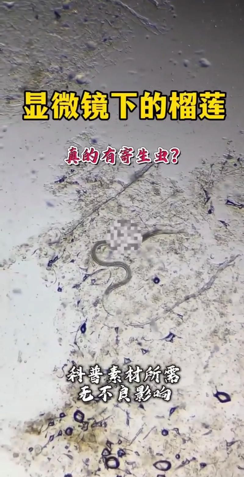 手機(jī)顯微鏡如何輔助診斷，arxiv論文助手可輔助手機(jī)顯微鏡如何輔助診斷