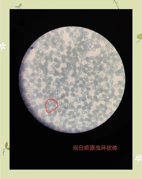 手機(jī)顯微鏡如何輔助診斷，arxiv論文助手可輔助手機(jī)顯微鏡如何輔助診斷