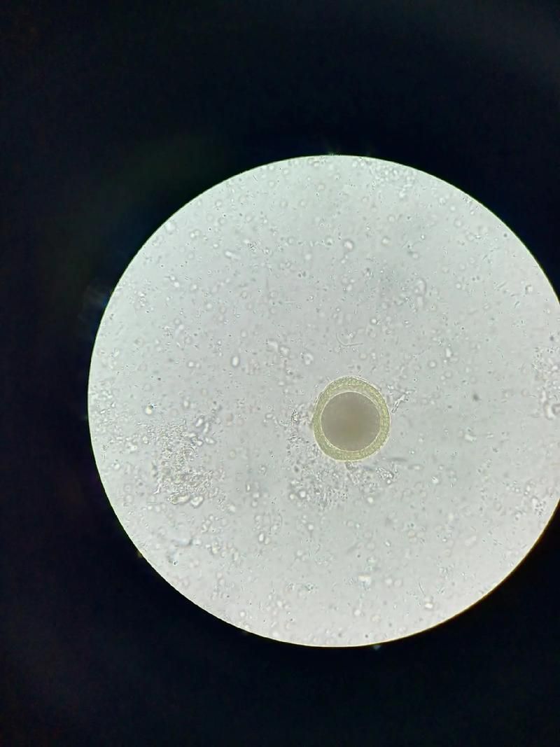 手機(jī)顯微鏡如何輔助診斷，arxiv論文助手可輔助手機(jī)顯微鏡如何輔助診斷