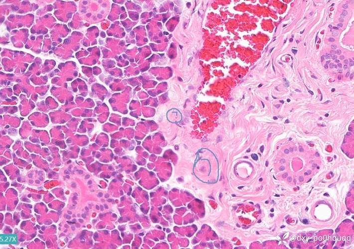 如何判斷龍魚腮腫是細菌感染還是寄生蟲？，如何判斷龍魚腮腫是寄生蟲感染還是寄生蟲感染還是寄生蟲