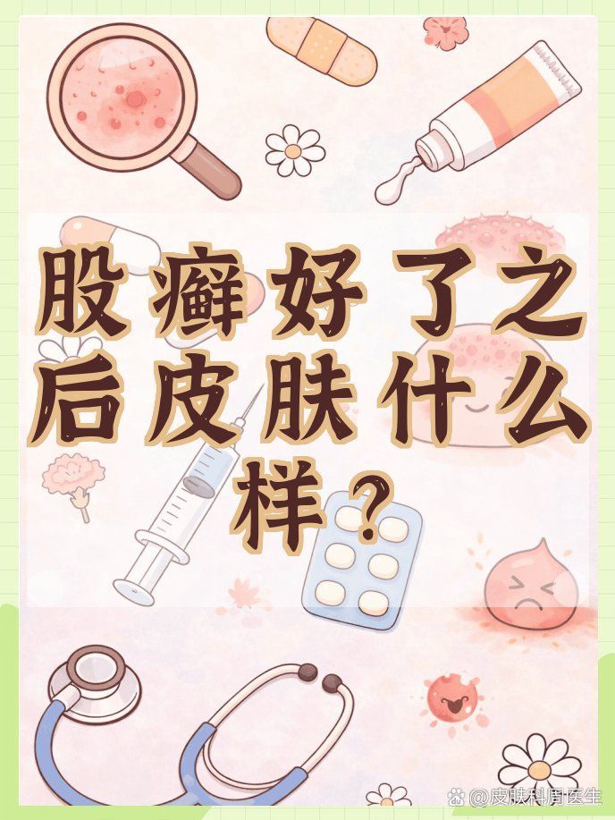 如何判斷皮膚癬菌病是否好轉，判斷皮膚癬菌病好轉是否好轉，皮膚癬菌病好轉是否好轉