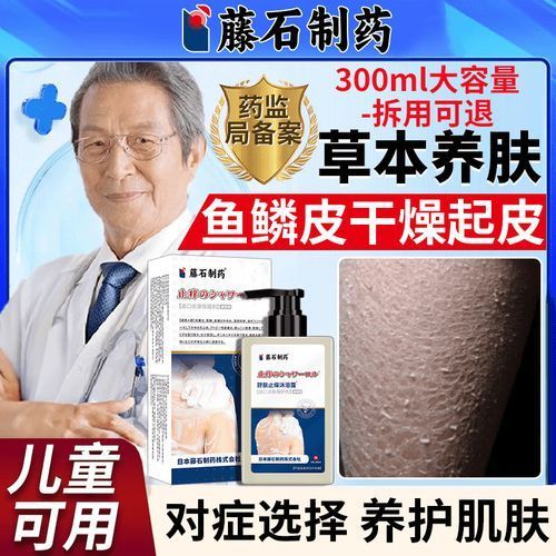 有哪些適合魚鱗病人的沐浴露推薦，適合魚鱗病人的沐浴露