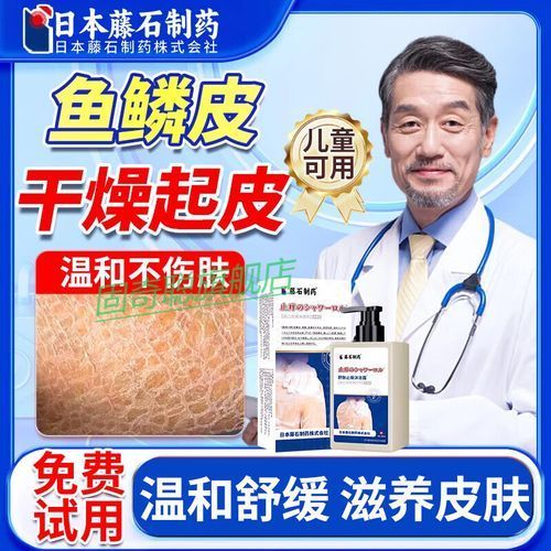 有哪些適合魚鱗病人的沐浴露推薦，適合魚鱗病人的沐浴露