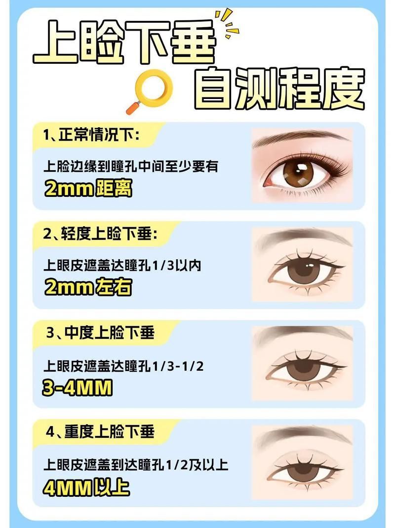 如何判斷自己是否掉眼，如何判斷上瞼下垂