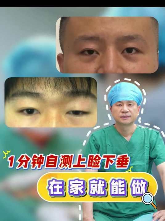 如何判斷自己是否掉眼，如何判斷上瞼下垂