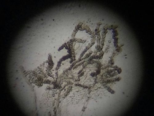 如何判斷魚鰓是否爛了，如何判斷魚鰓是否爛了———科學(xué)診斷指南