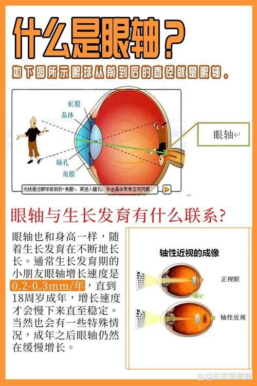 益生菌如何降低眼部感染率，arxiv論文助手arxiv論文助手arxiv論文助手