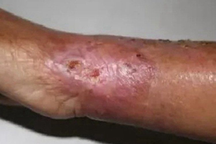 如何判斷海水魚是否體表細菌感染，如何判斷海水魚是否體表細菌感染（arxiv論文助手”