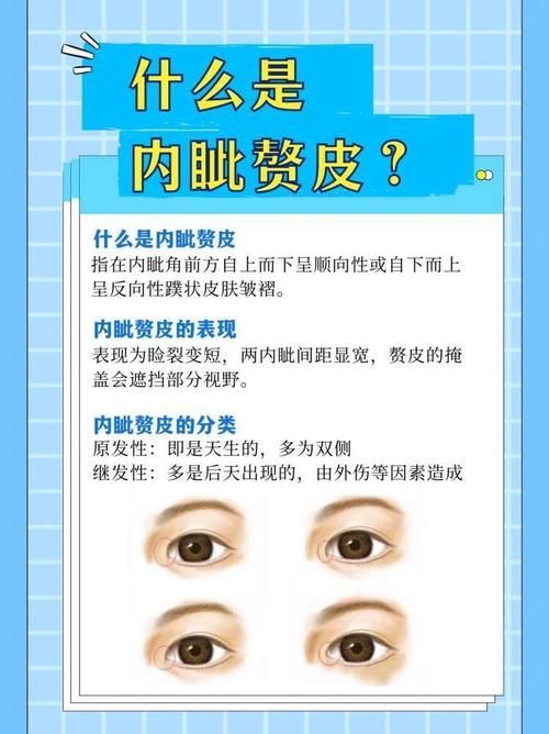 如何區(qū)分外蒙眼和內(nèi)蒙眼，“內(nèi)蒙眼”并非標準醫(yī)學術(shù)語