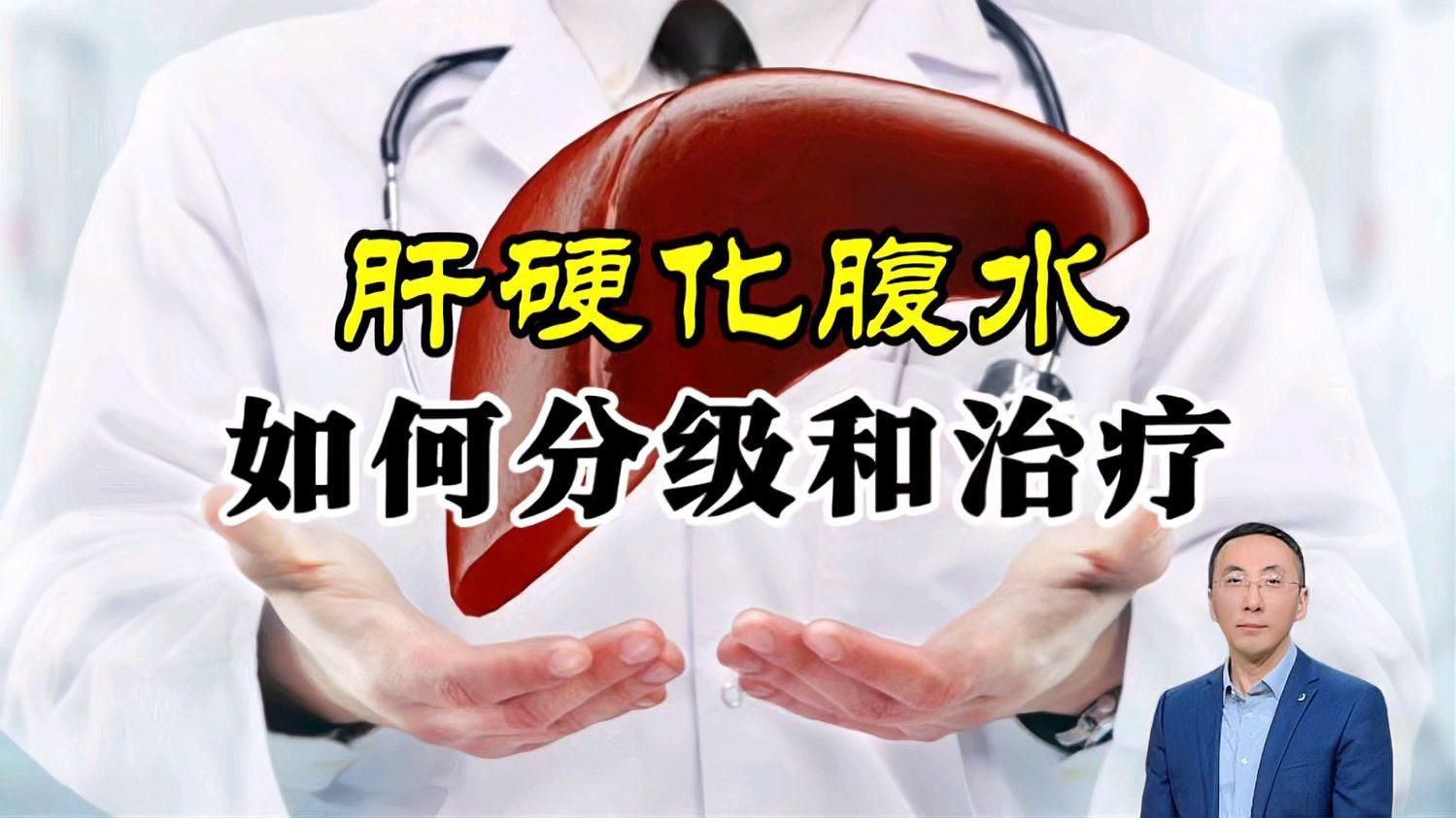 哪種類型的魚腹水治療最困難，哪種類型的魚腹水最困難