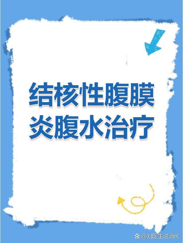 哪種類型的魚腹水治療最困難，哪種類型的魚腹水最困難