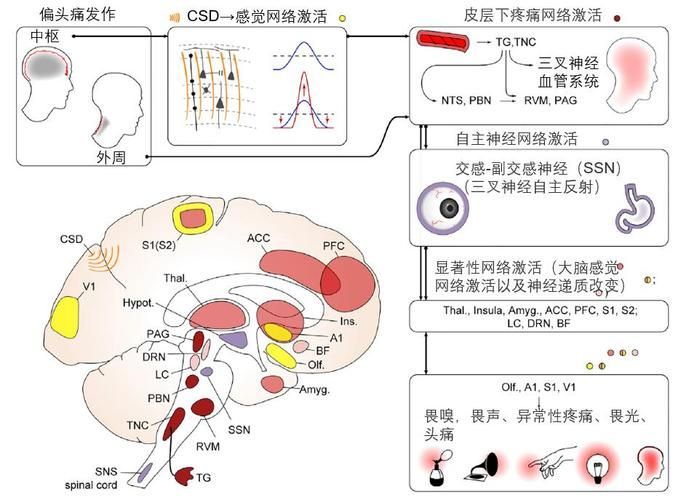 哪種治療方法最適合我，中華醫學會《中國偏頭痛診斷與治療指南》1000字詳解
