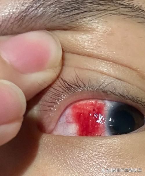 如何判斷龍魚是否缺乏維生素A或C？，如何判斷龍魚是否缺乏維生素a或c