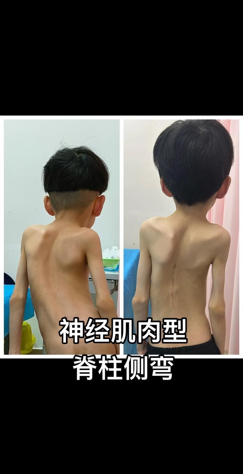 如何判斷龍魚是否缺乏維生素A或C？，如何判斷龍魚是否缺乏維生素a或c
