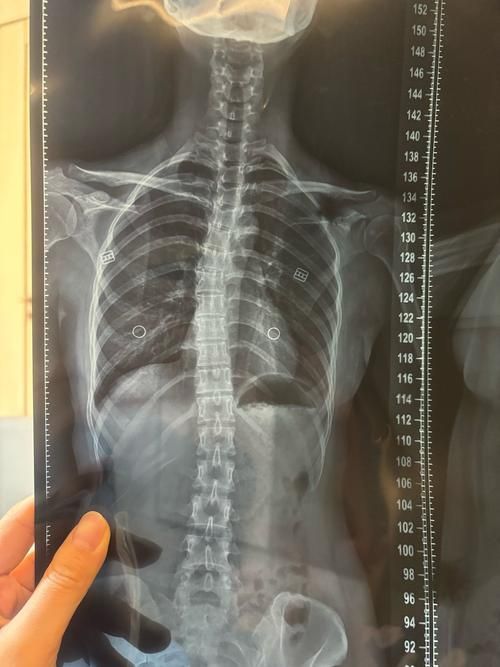 如何判斷龍魚是否缺乏維生素A或C？，如何判斷龍魚是否缺乏維生素a或c